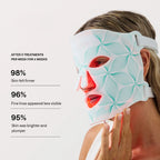 Skinnoir LED Face Mask
