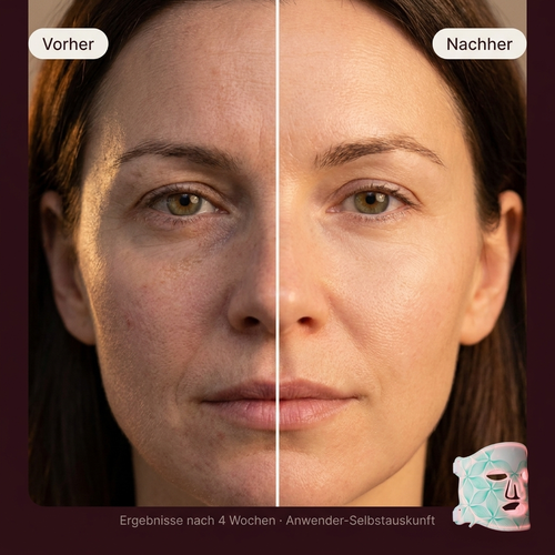 Skinnoir LED Face Mask